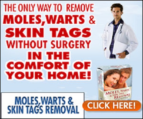 safe mole removal